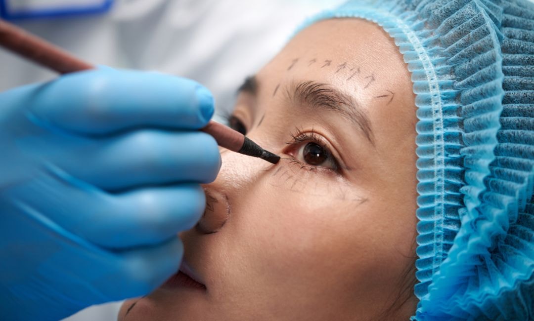 How the Procedure Works Step by Step