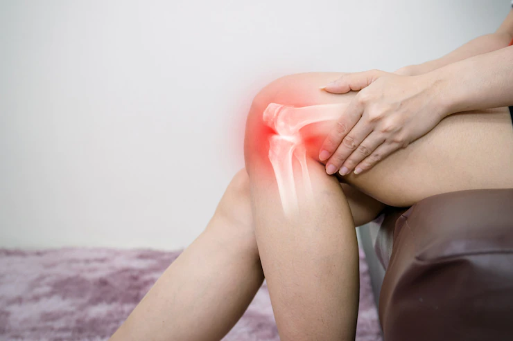  Prolonged inflammation may result in chronic disease which may manifest as joint pain.