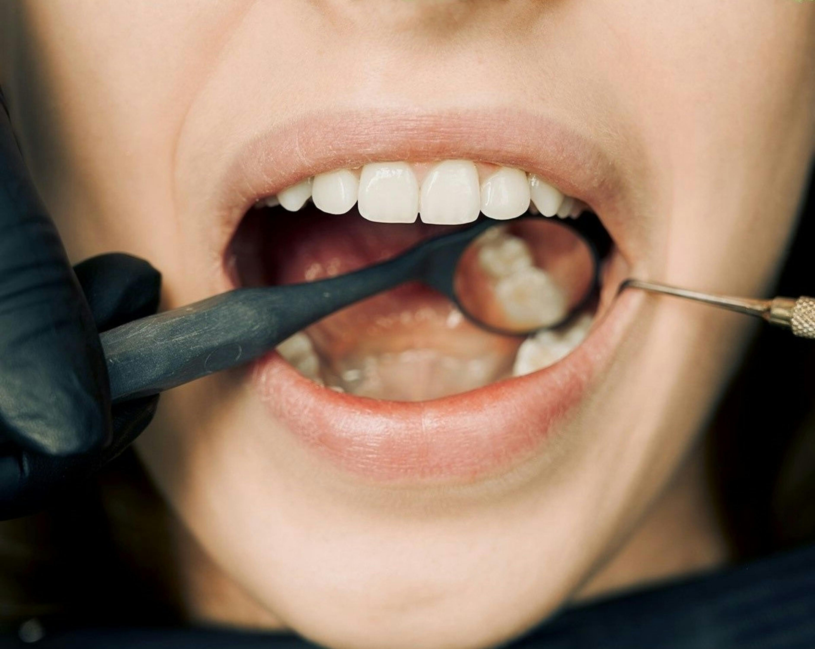 a woman's natural teeth which is what we want dental implants in calgary to look like