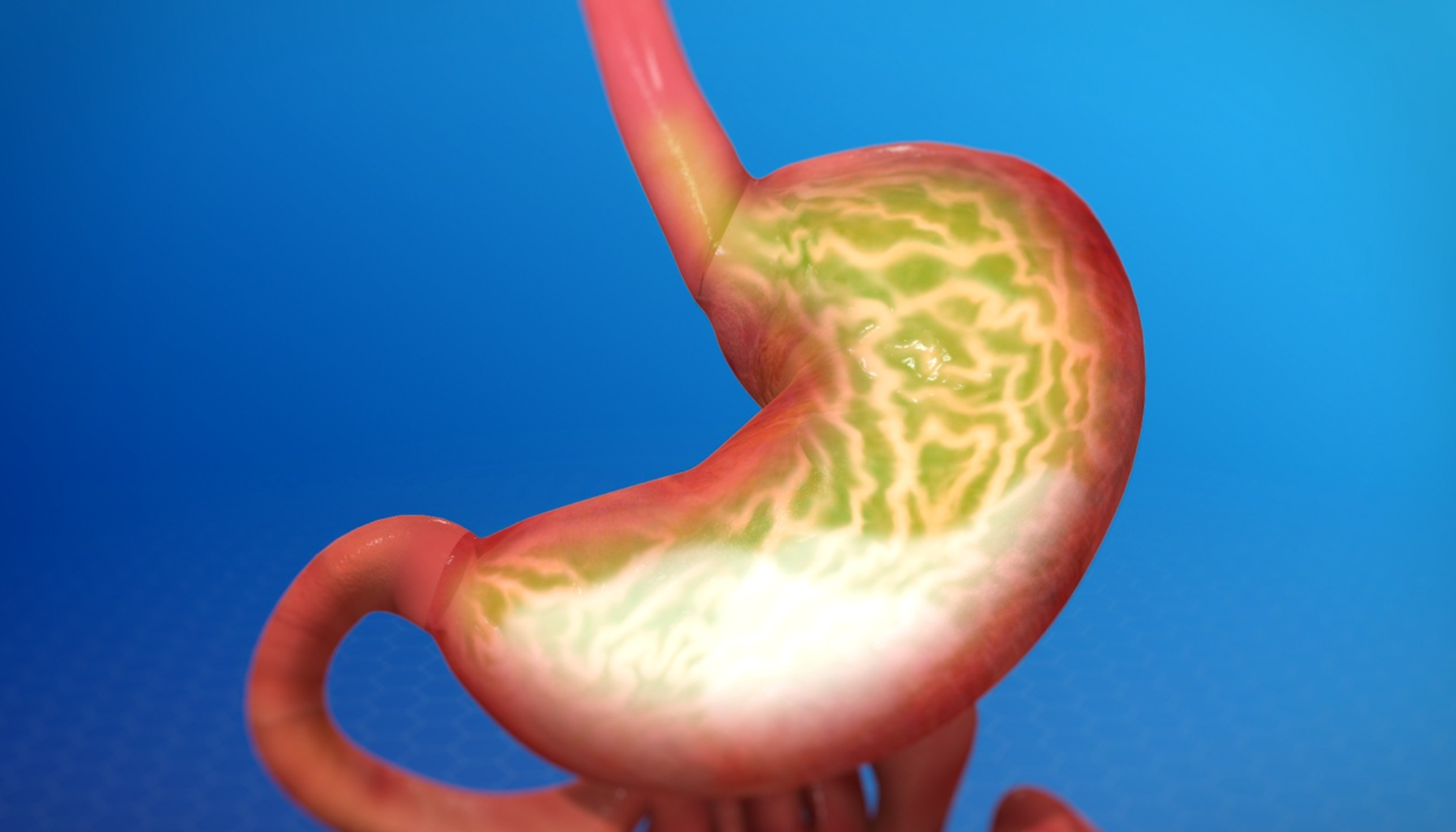 Halsbrann: Når Brystet Brenner og Du Skylder På Tacoen 16 Illustrasjon av menneskelig mage med magesyre og slimhinne.