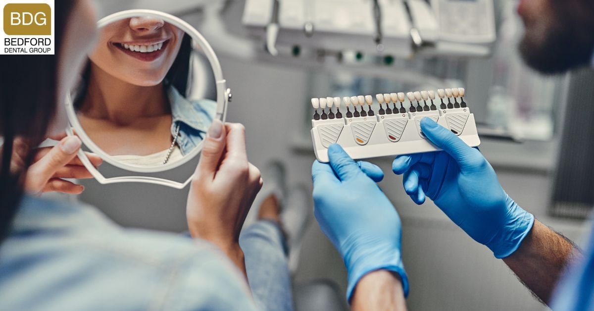 What are Veneers?