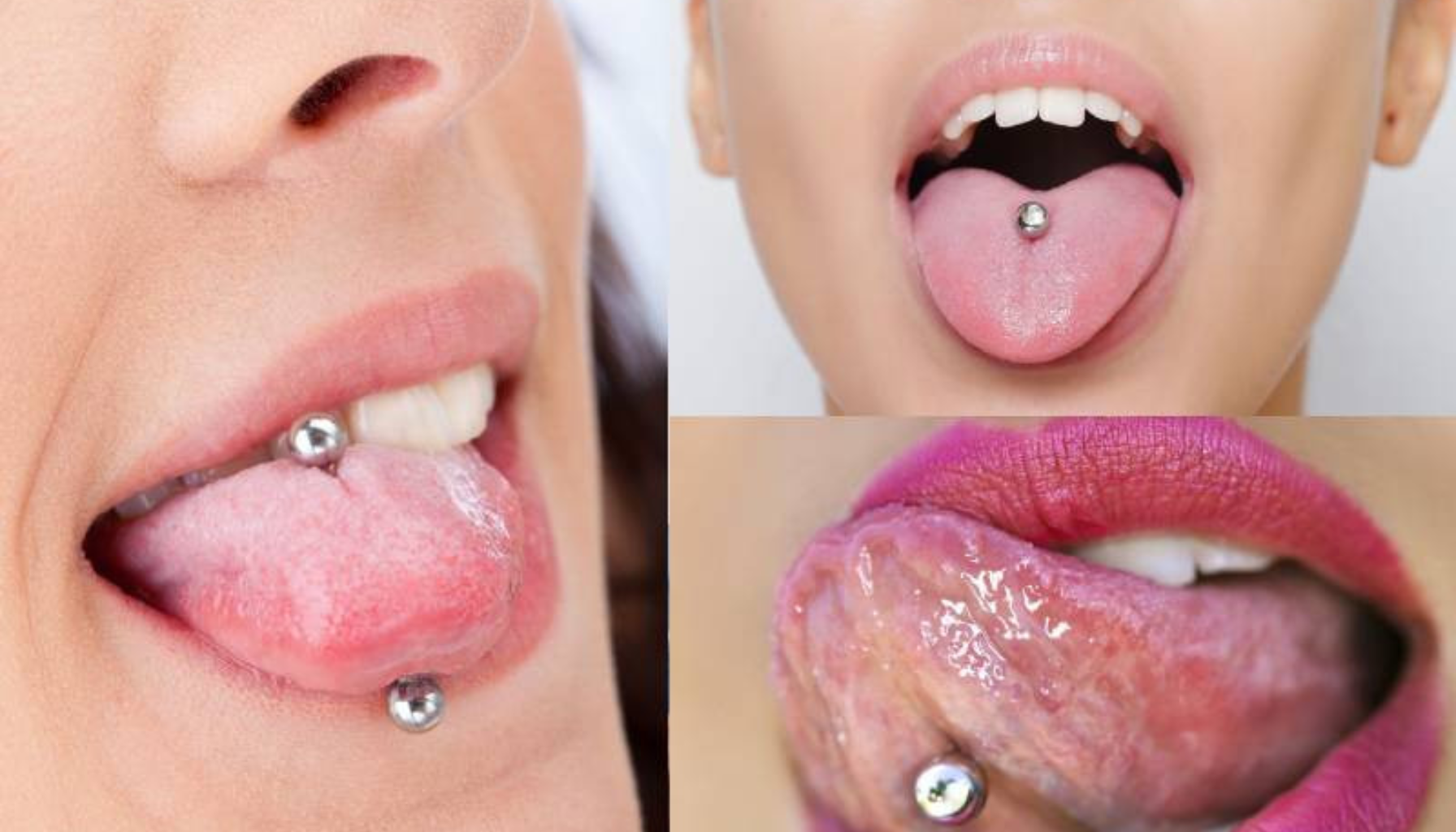 Tre nærbilder av tunge med tungepiercing, hvorav ett viser irritasjon og rødhet rundt piercingen.