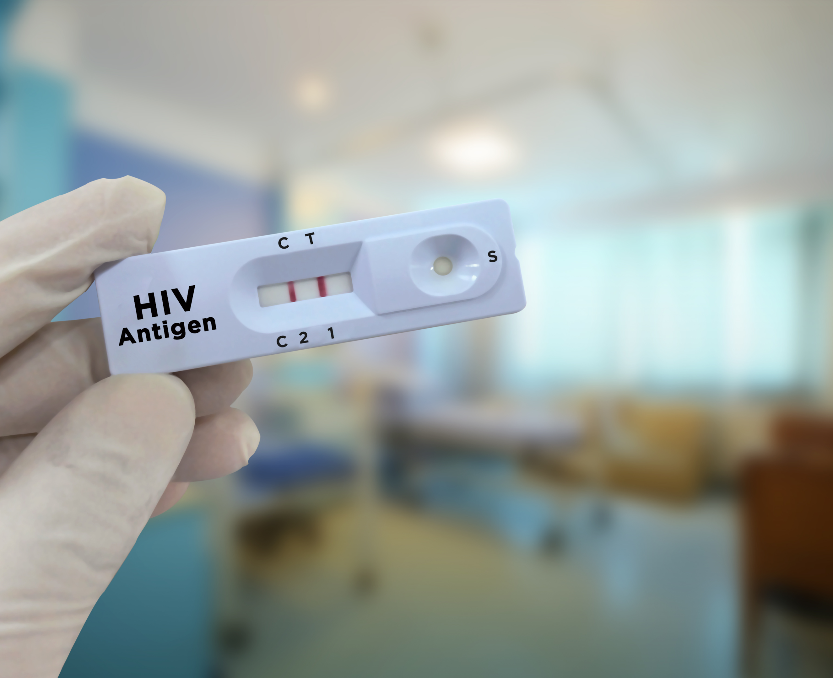 A doctor holding the HIV rapid test cassette.