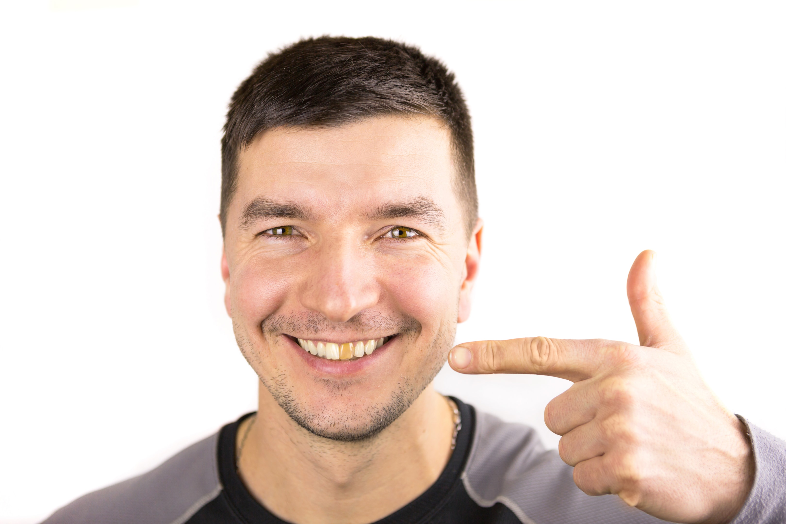 a man who has decided to get a crown in the future to cover his damaged tooth