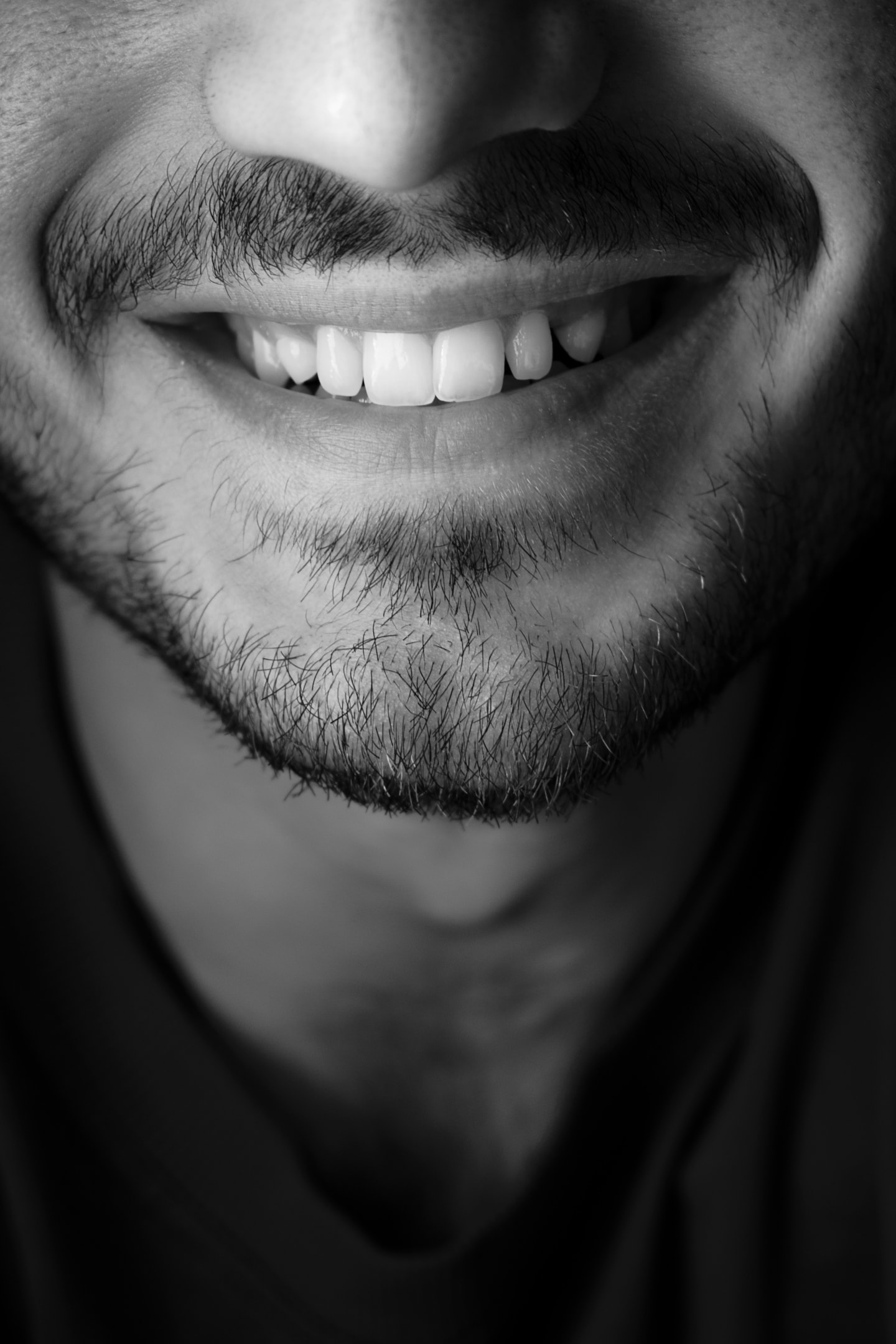 A visual guide comparing white fillings to other types of fillings.