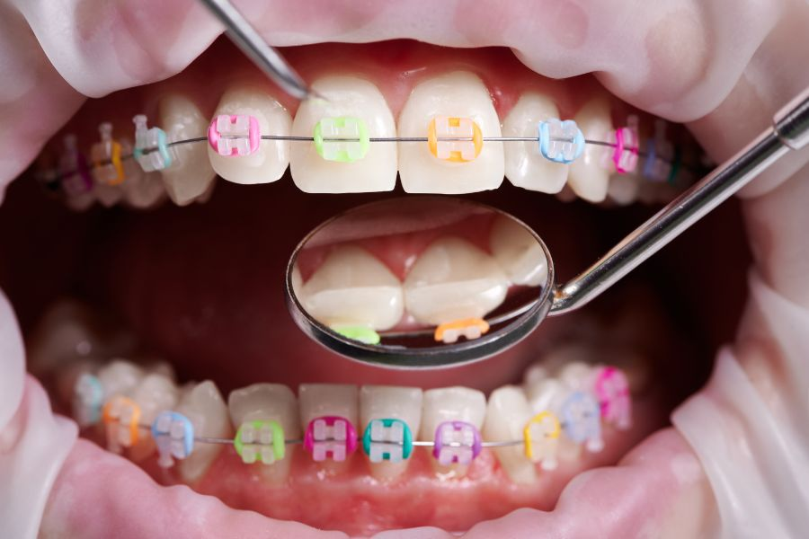 plan leczenia u ortodonty, planowane leczenie protetyczne