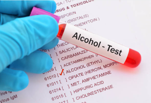avoid drinking alcohol beore a test to avoid inaccurate blood test results