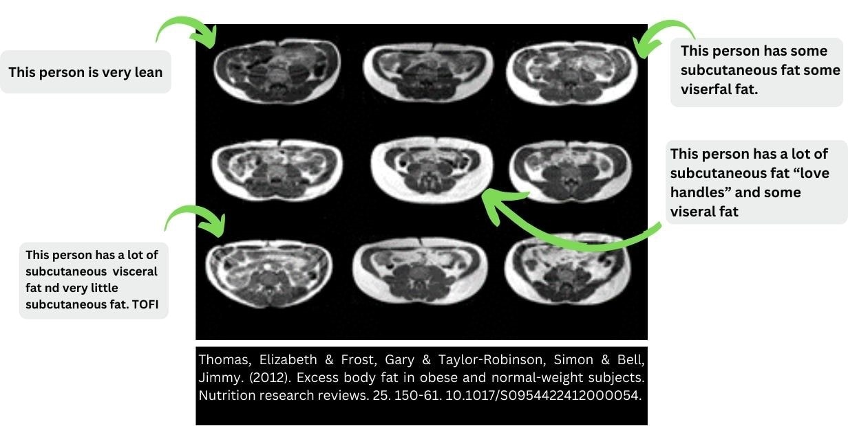 A close-up of an x-ray