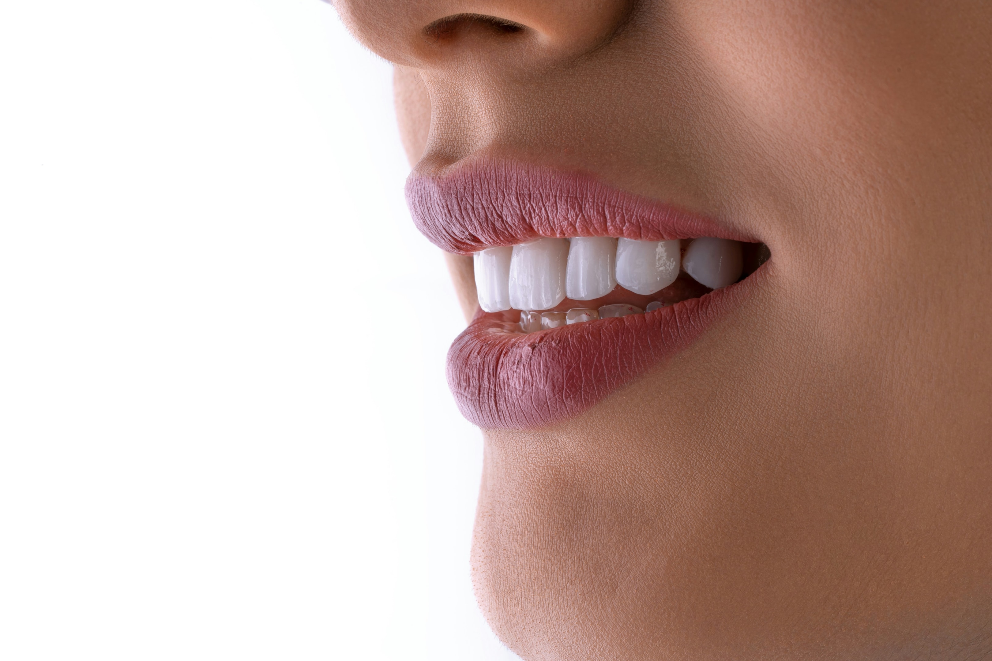 A graphic showing the cost factors associated with white fillings in Perth.