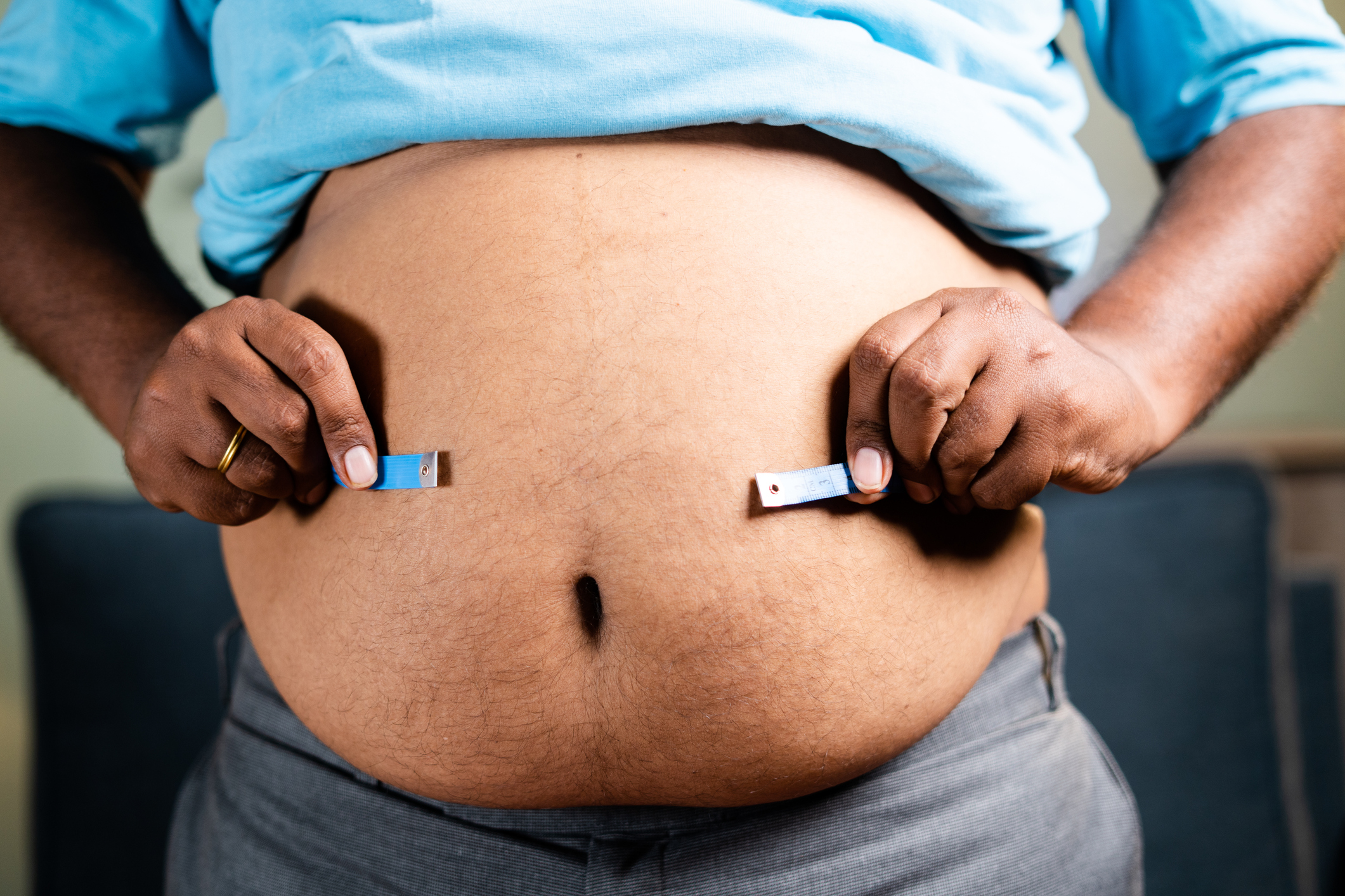 An image of an obese man measuring his bulging stomach.