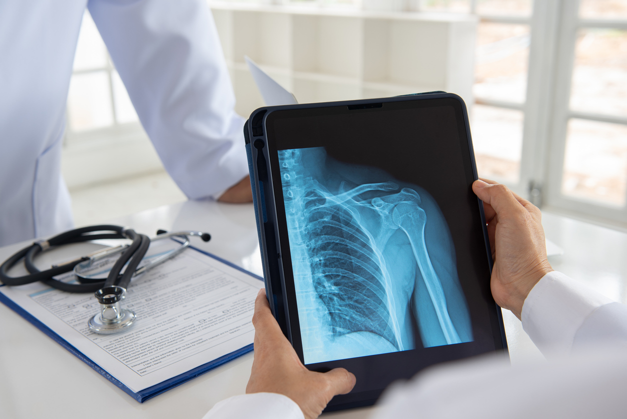 imaging tests for significant pain, crushing pain, or severe injury of shoulder joints