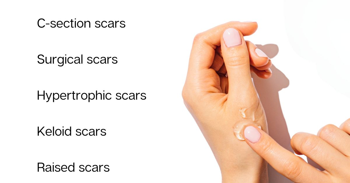Addressing different kinds of scars