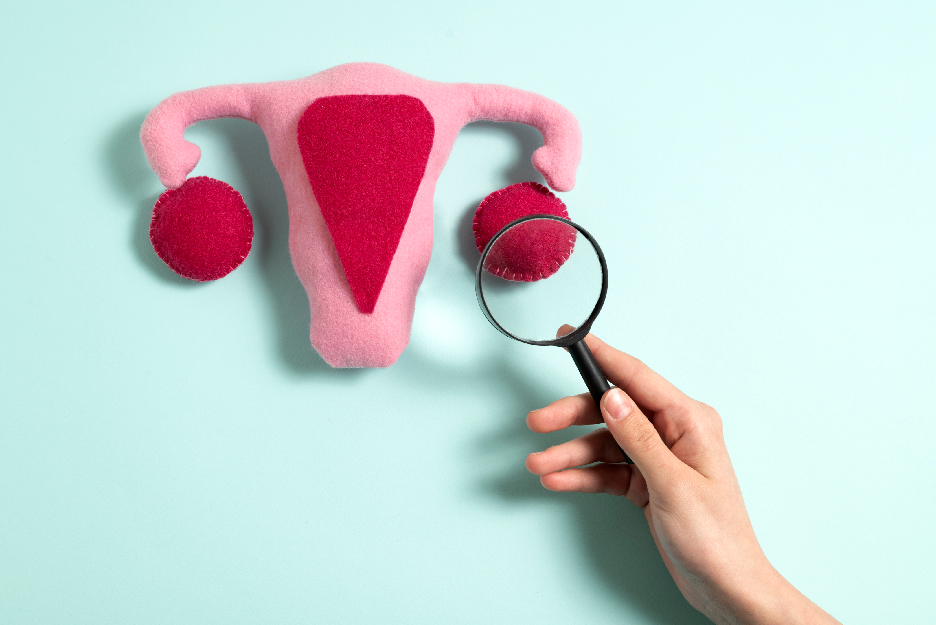Cysts may be present on a single or both the ovaries