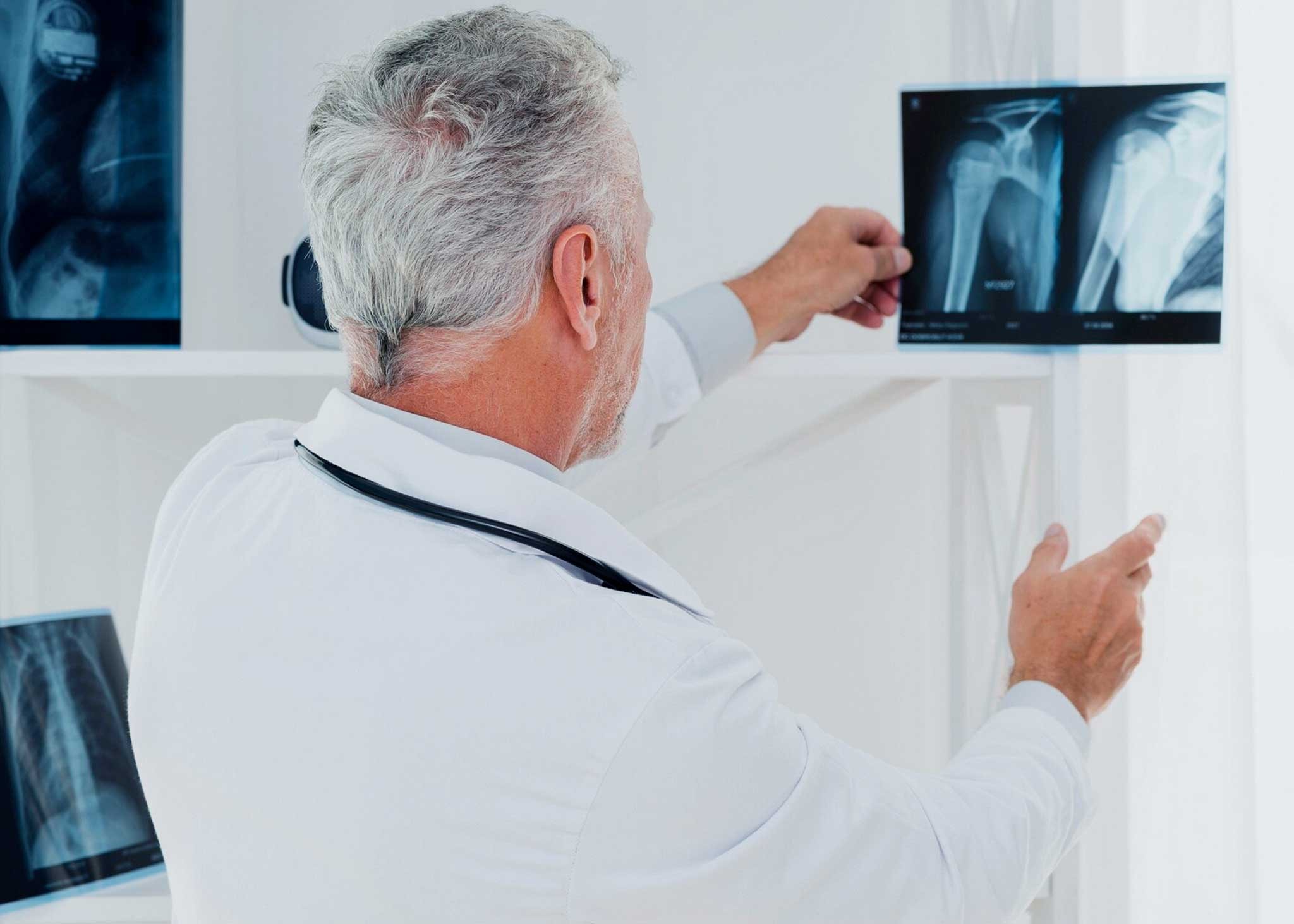 Lekarz oglądający obraz rtg stawu barkowego