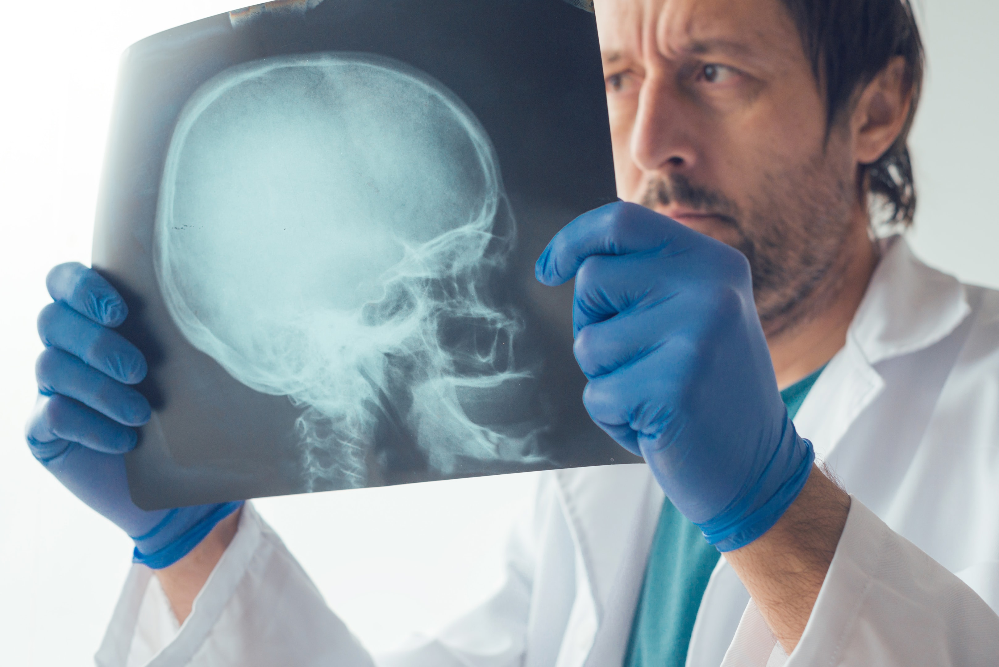 a oral and maxillofacial surgeon studying an x-ray after jaw surgery