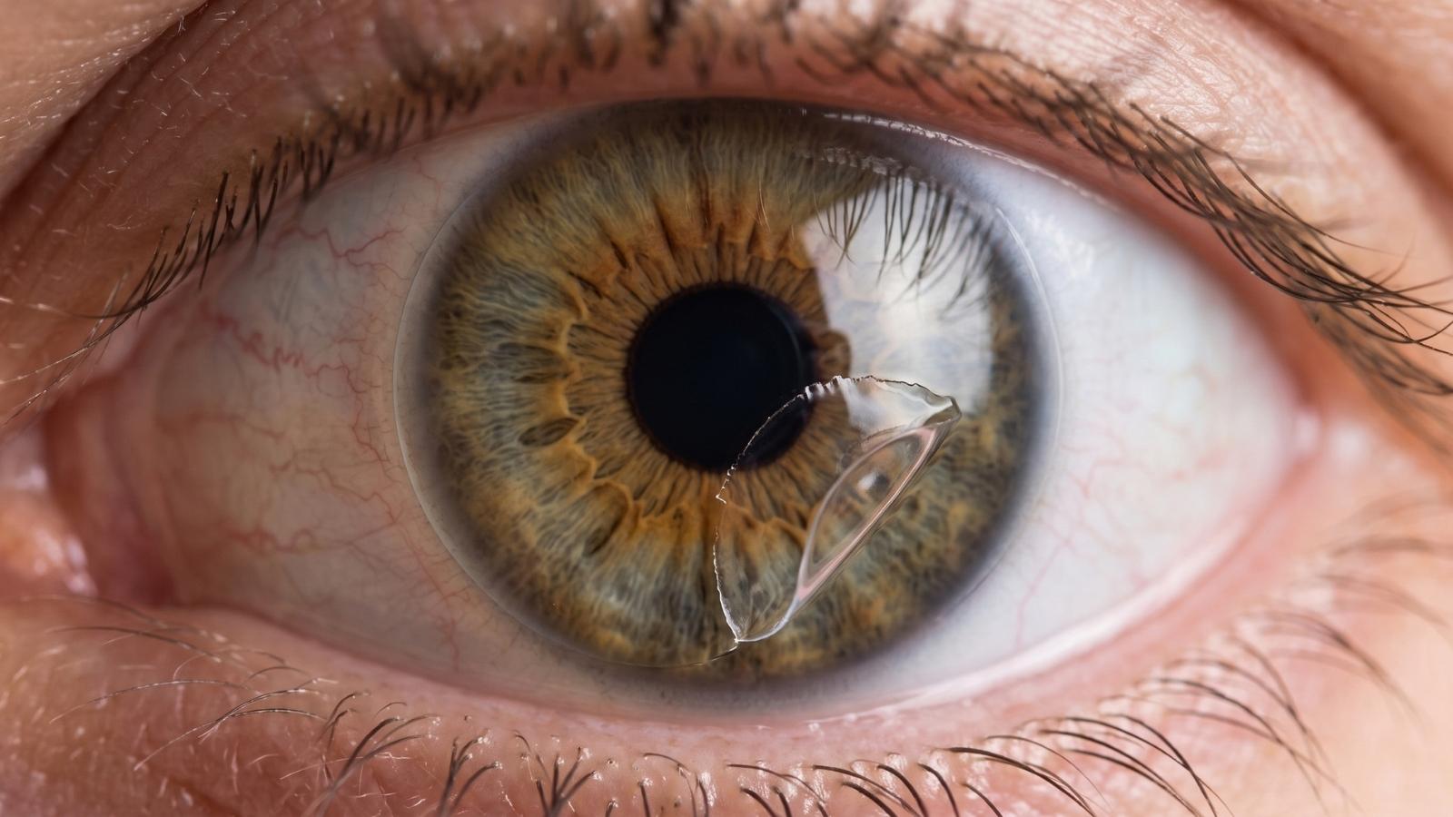 eye updated