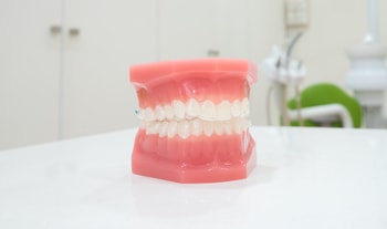 dental implant