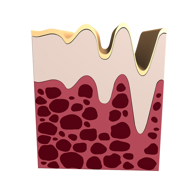 An illustration of the epidermal layer and collagen.