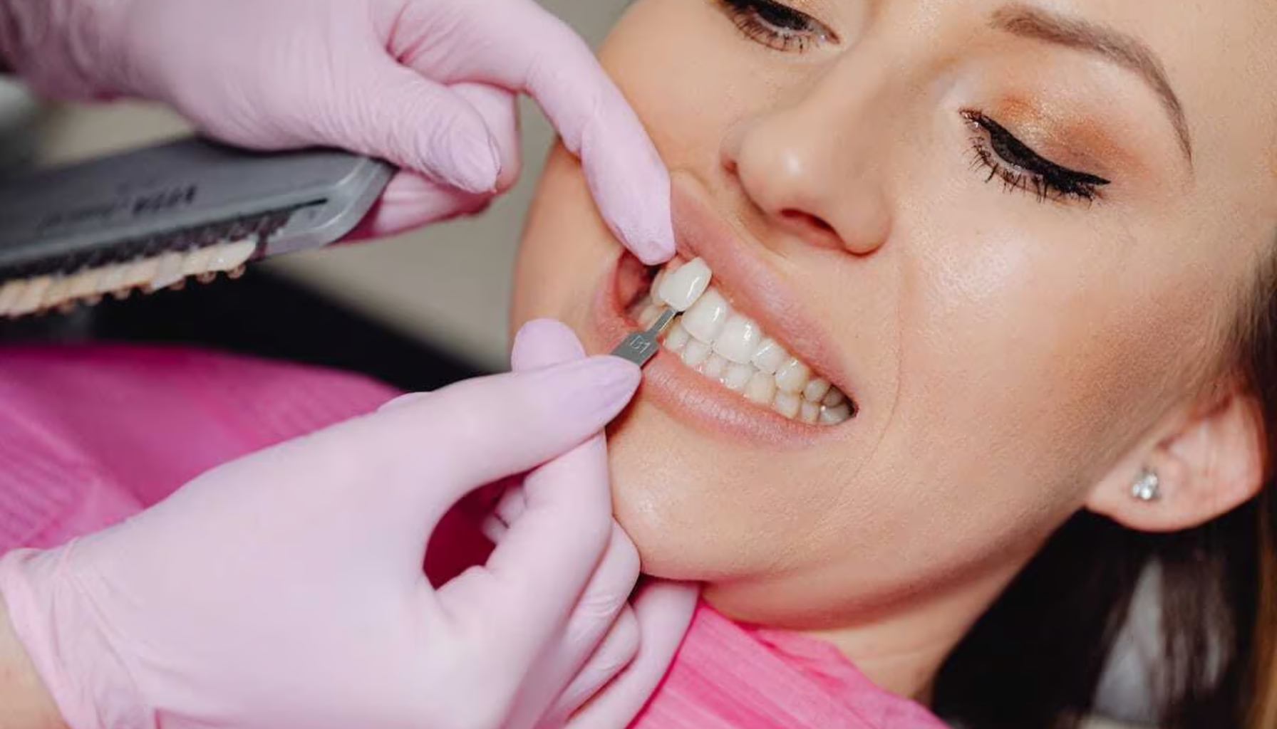 "Kvinne i tannlegestol får sammenlignet tannfarge med fargeskala for tilpasning av tannbehandling eller fasetter."