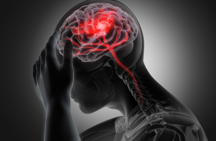 A graphical image of a human with an inflamed brain. 