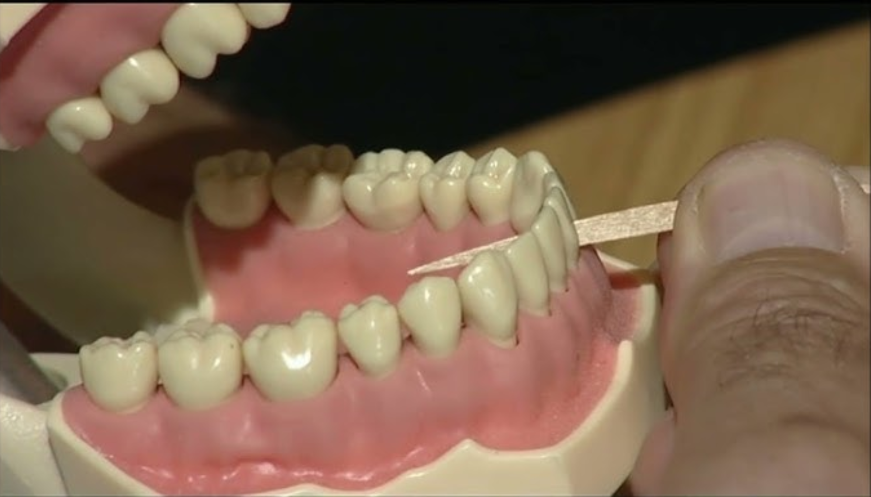 "Nærbilde av hånd som bruker tannpirkere på en modell av menneskelige tenner og tannkjøtt."