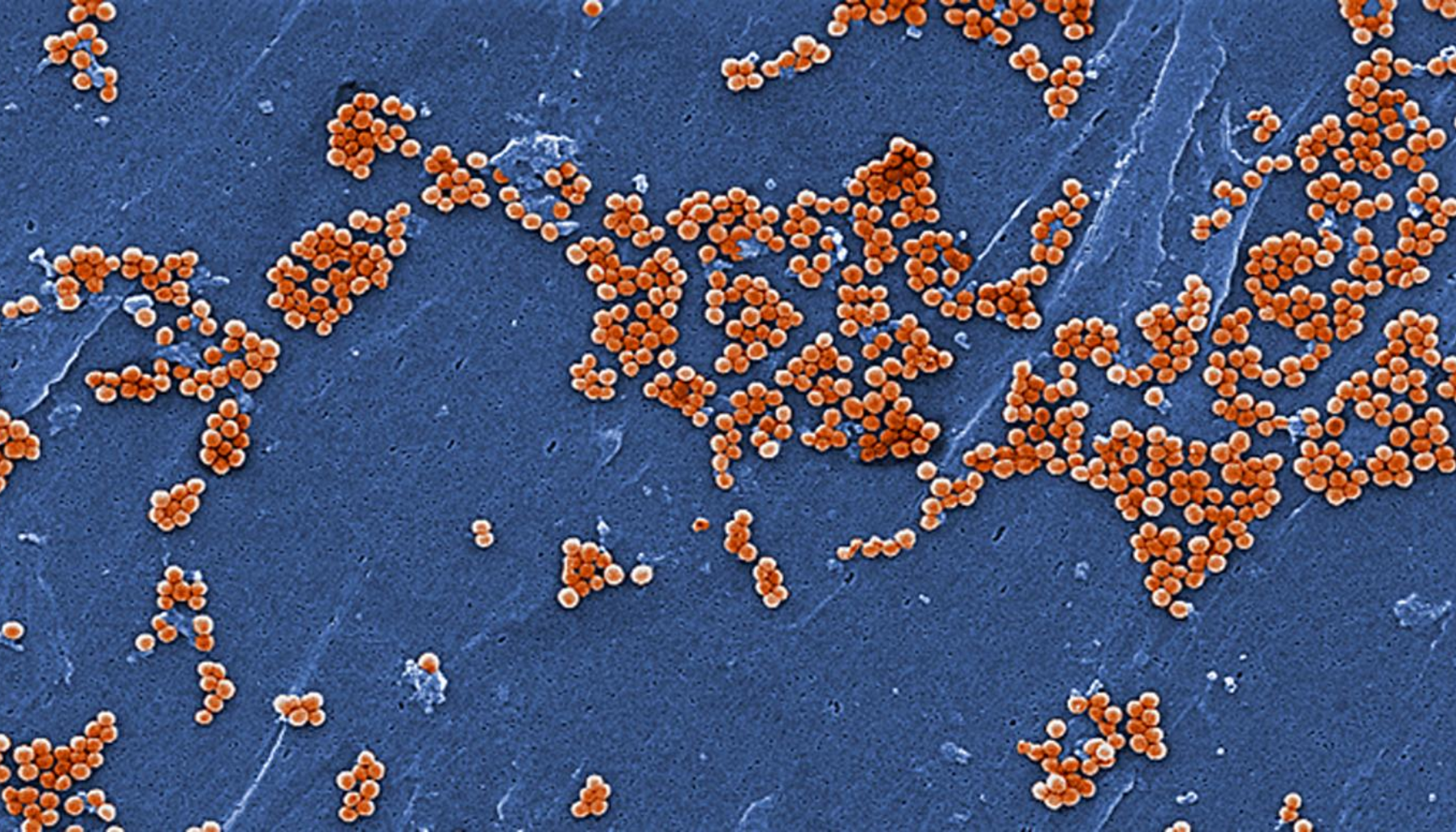 Mikroskopisk fremstilling av stafylokokker i klynger.