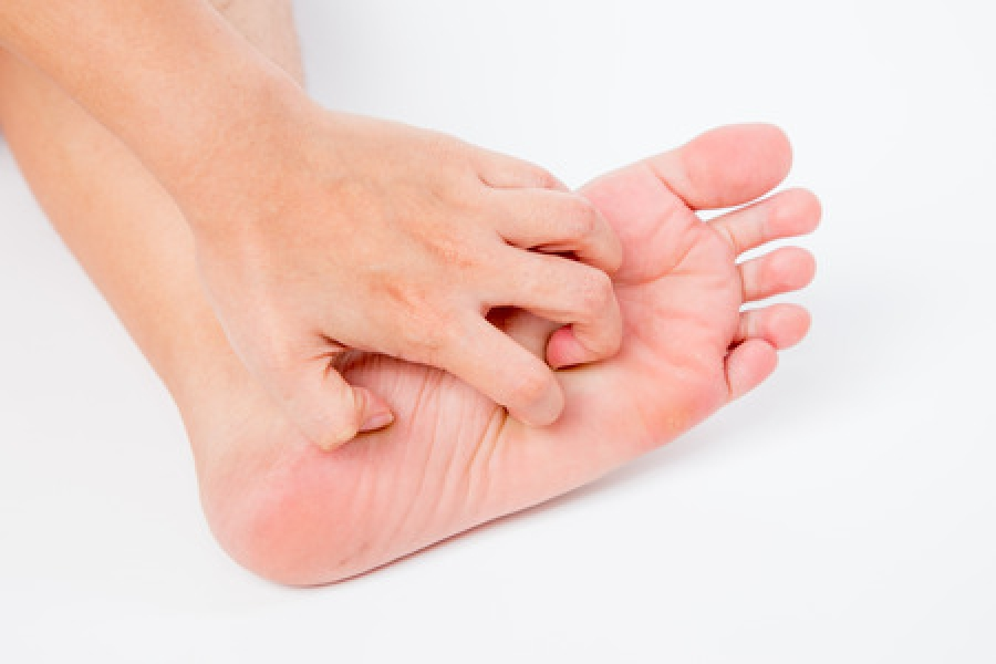 get athlete's foot, fungal cells, scaly skin