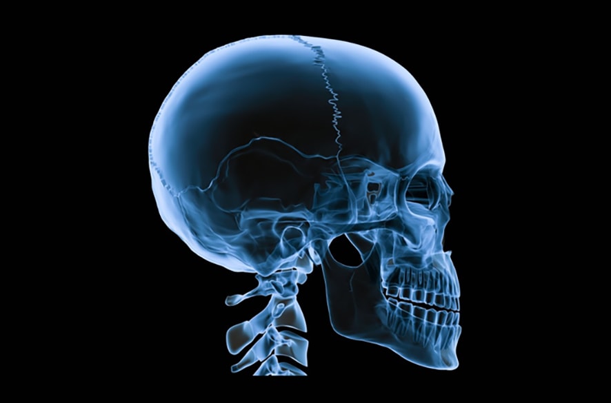 skull x-ray representing oral and maxillofacial surgery 