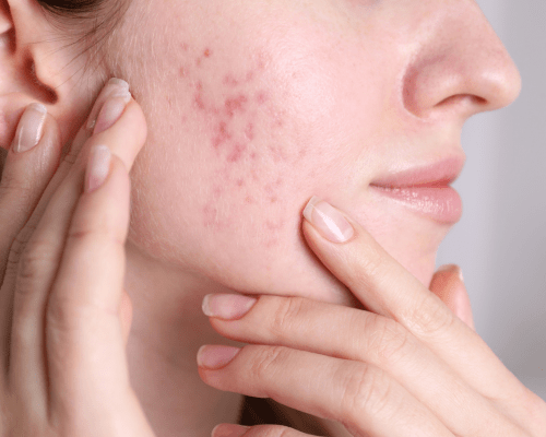 what are signs of hormone imbalance