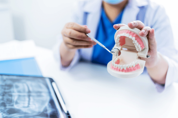 surgeon holding dental jaw model explaining jaw surgery procedure