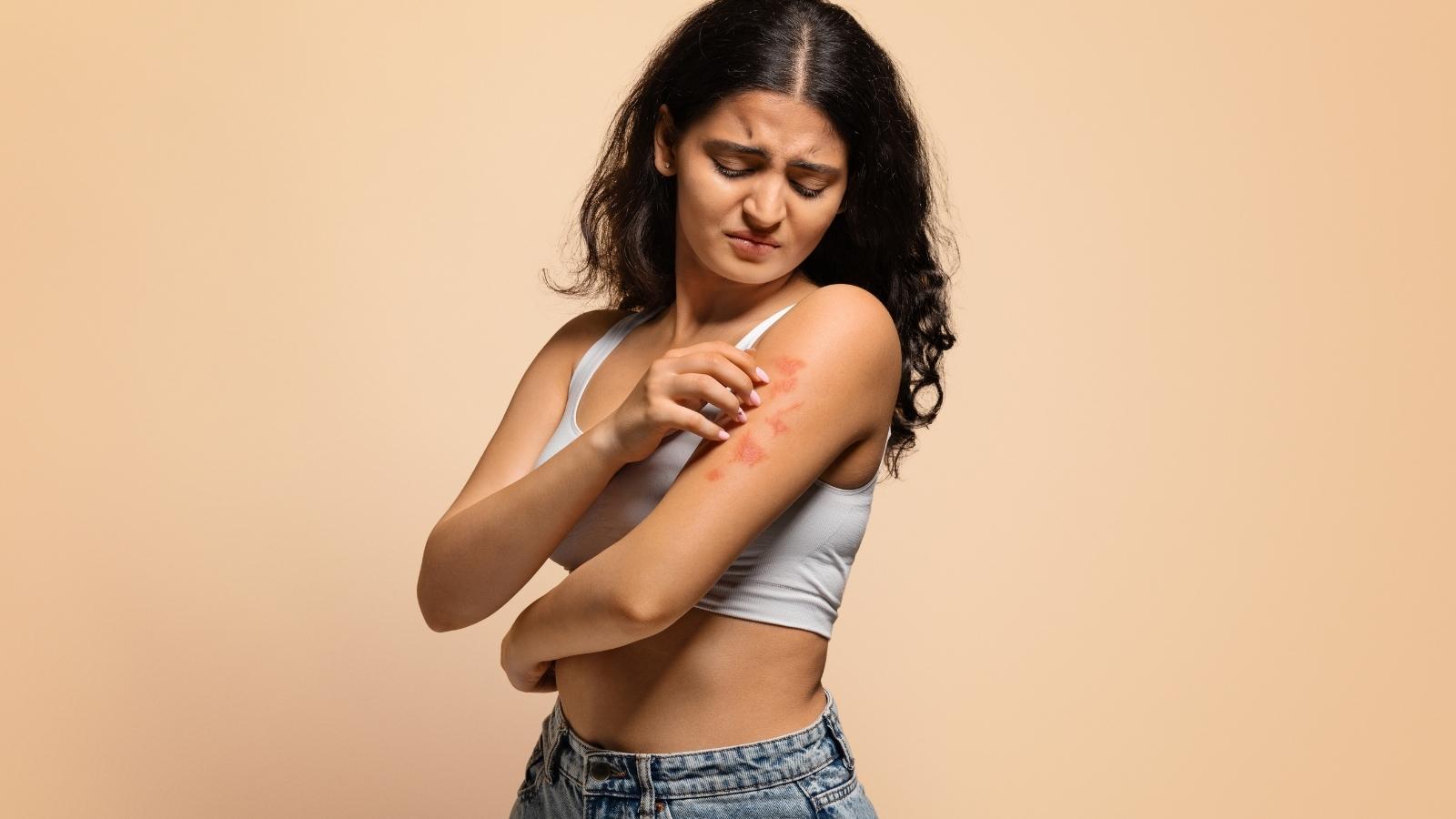 affected skin