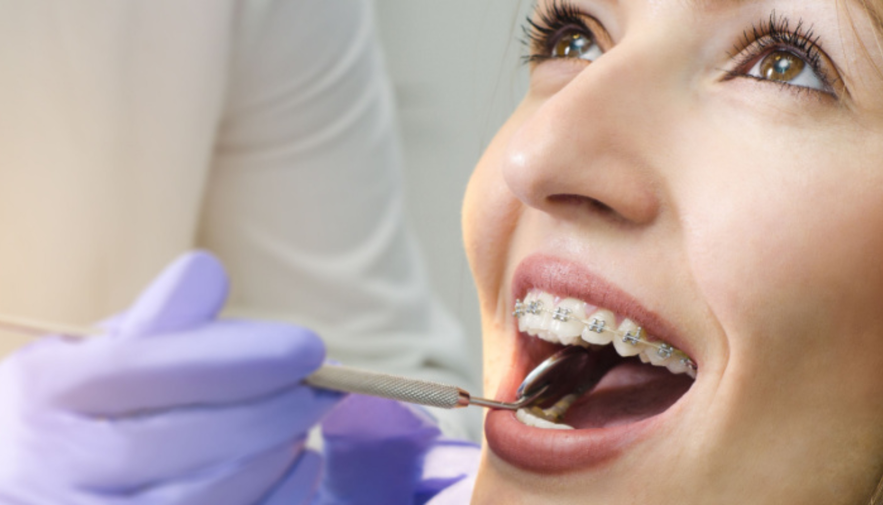 Kvinne med tannregulering får kontroll hos tannlegen.