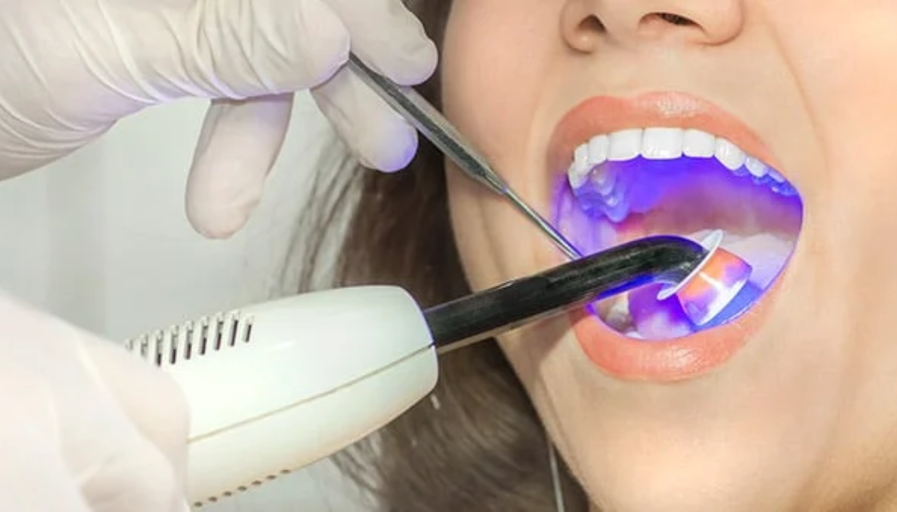 Rotfylle Pris: Hva Koster Det – og Hvorfor?