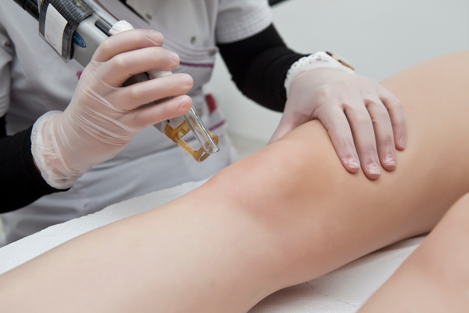 treatments laser regeneration skin