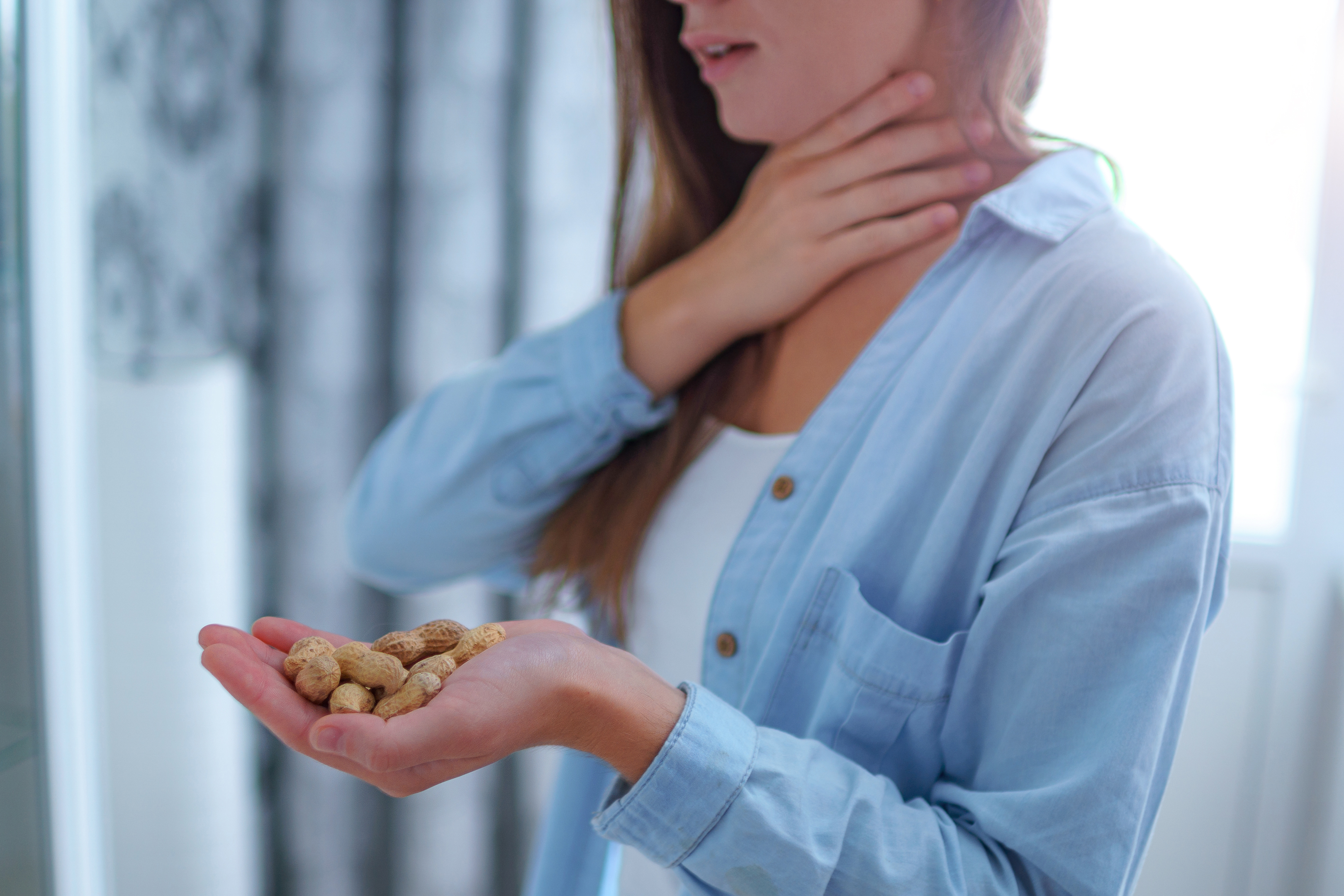 Symptoms, Cashew Allergy