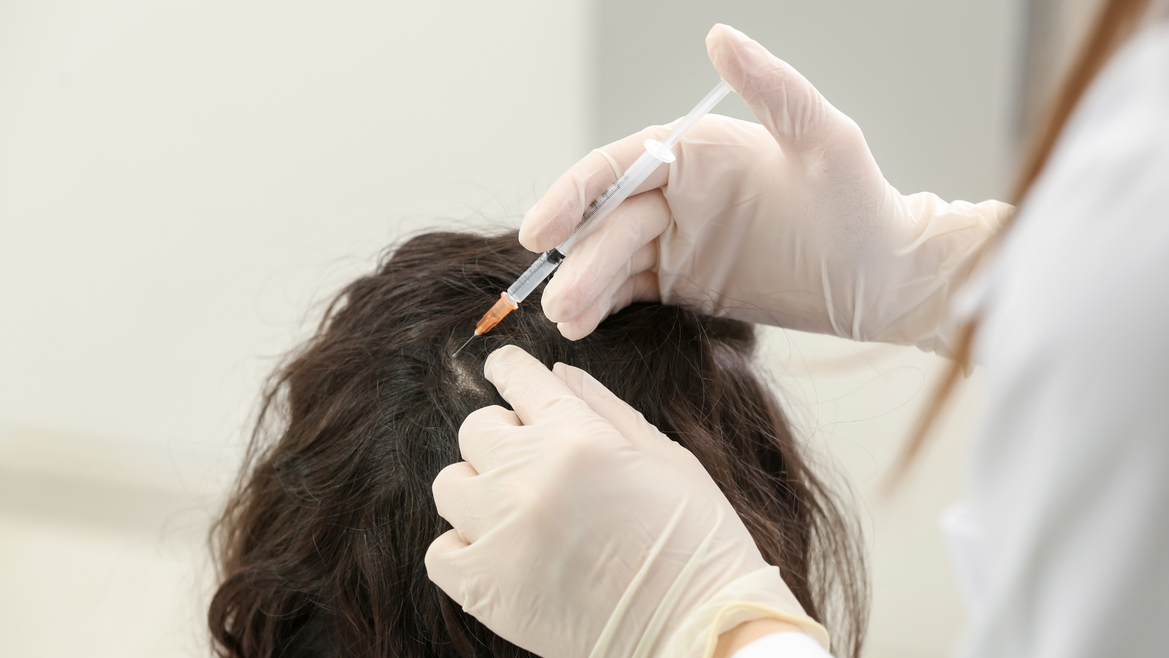 Why choose a hair transplant clinic?