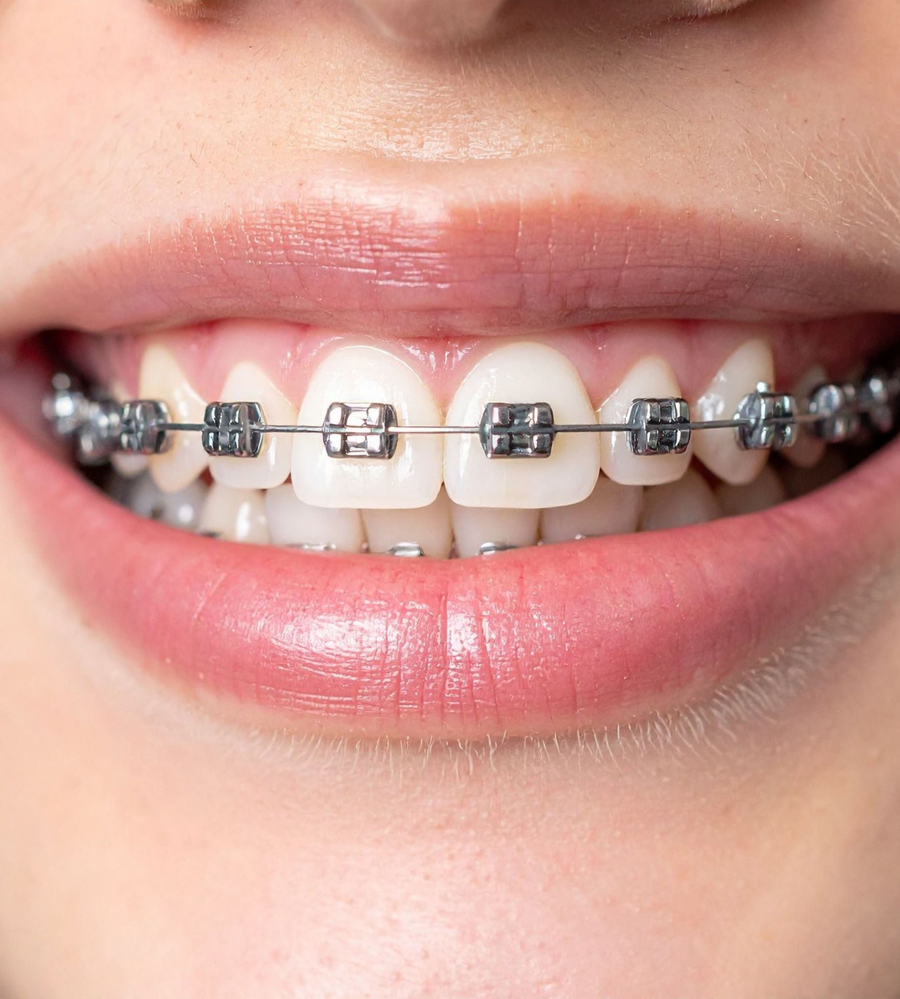 40f1d52f 2305 403c abf4 1227fe1f6f34