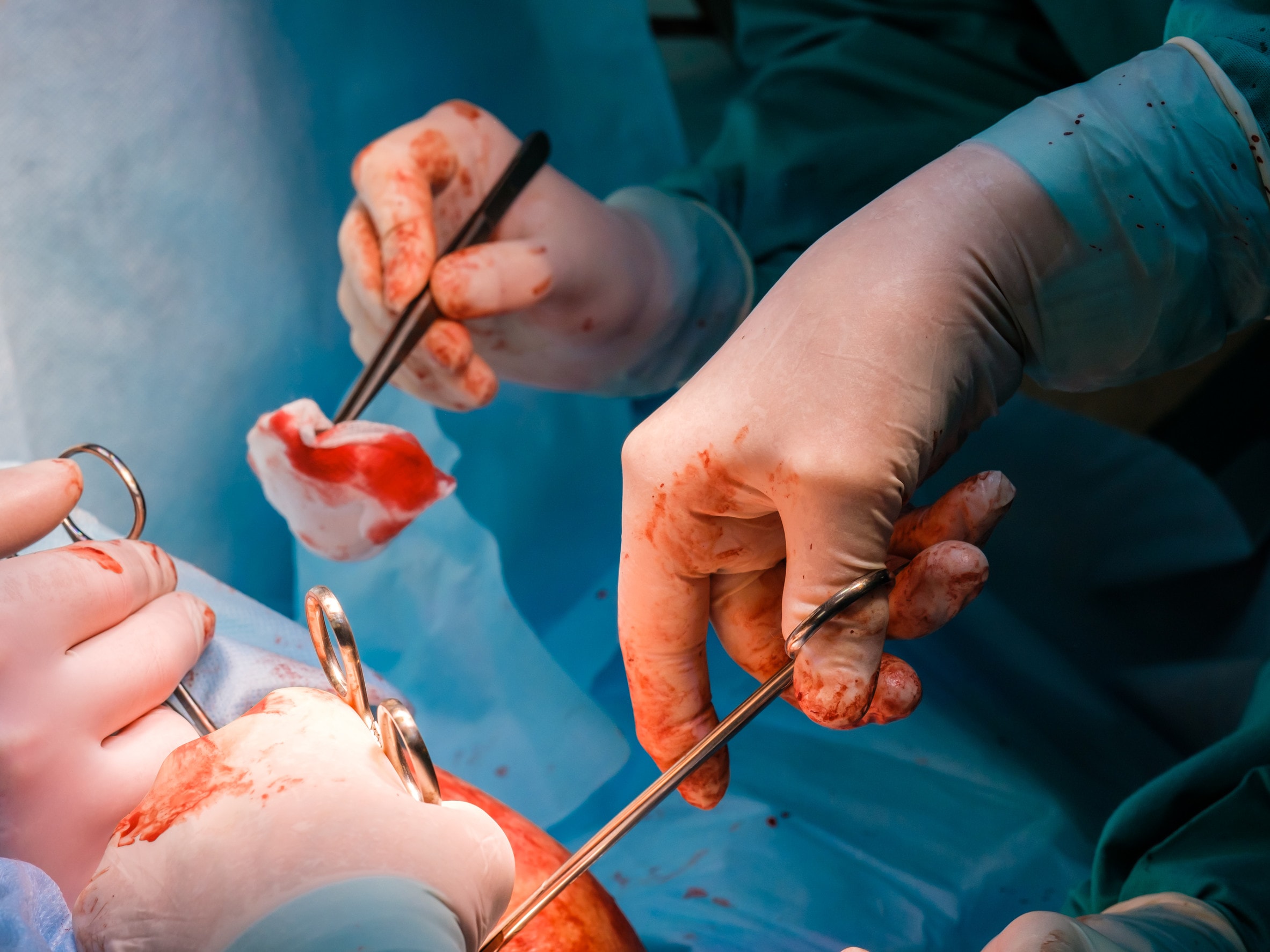 A team of surgeons performs surgical procedures on a patient