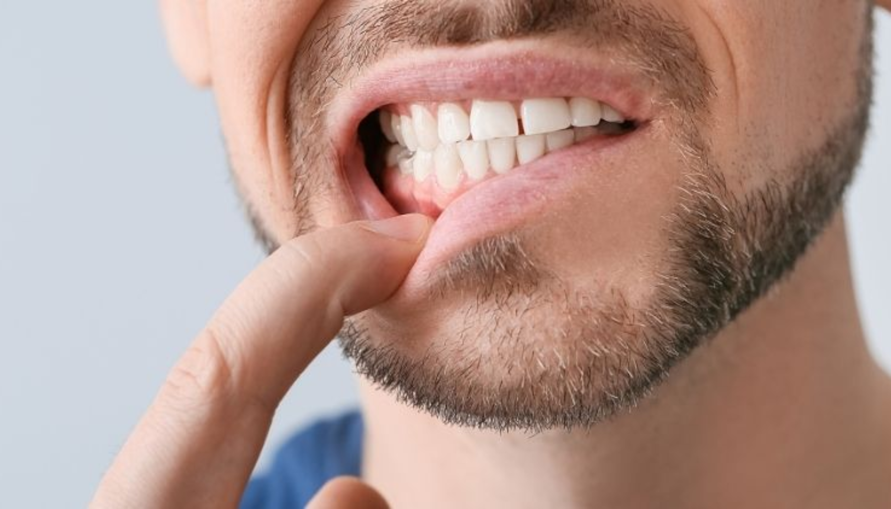 Gom Tenner: Når Tennene Ikke Møtes Som De Skal 14 Mann trekker ned underleppen og viser tannkjøtt og tenner, fokus på tannhelse og mulig irritasjon hos voksne gom tenner baksiden av tennene fast regulering gjennomsiktige skinner permanente tenner tennene usynlig tannregulering tannregulering regulering tenner gom behandling barn invisalign brukes fast tannlegen får bruke usynlig typer bittfeil munnen behandlingen klosser tid voksne bitt viktig ulike mindre plass under litt plate skinner gir hos god bruk permanente trenger derfor økt mer behov rette forskjellige bedre ofte kjeveortoped pasienten tar barnet bruker større mest stor streng gommen behandle ønsker holde skinnene typen bør klossene mye konsultasjon gjennom ganger vanlig godt finnes tradisjonell lang videre går gjerne mulig bittet