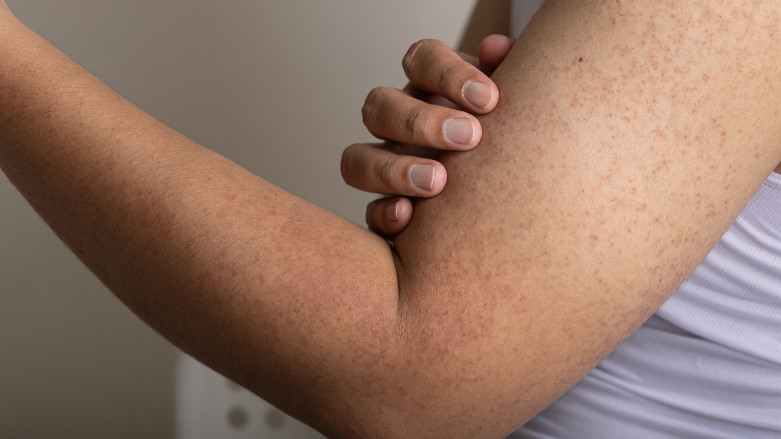 Person examining strawberry skin on upper arms.