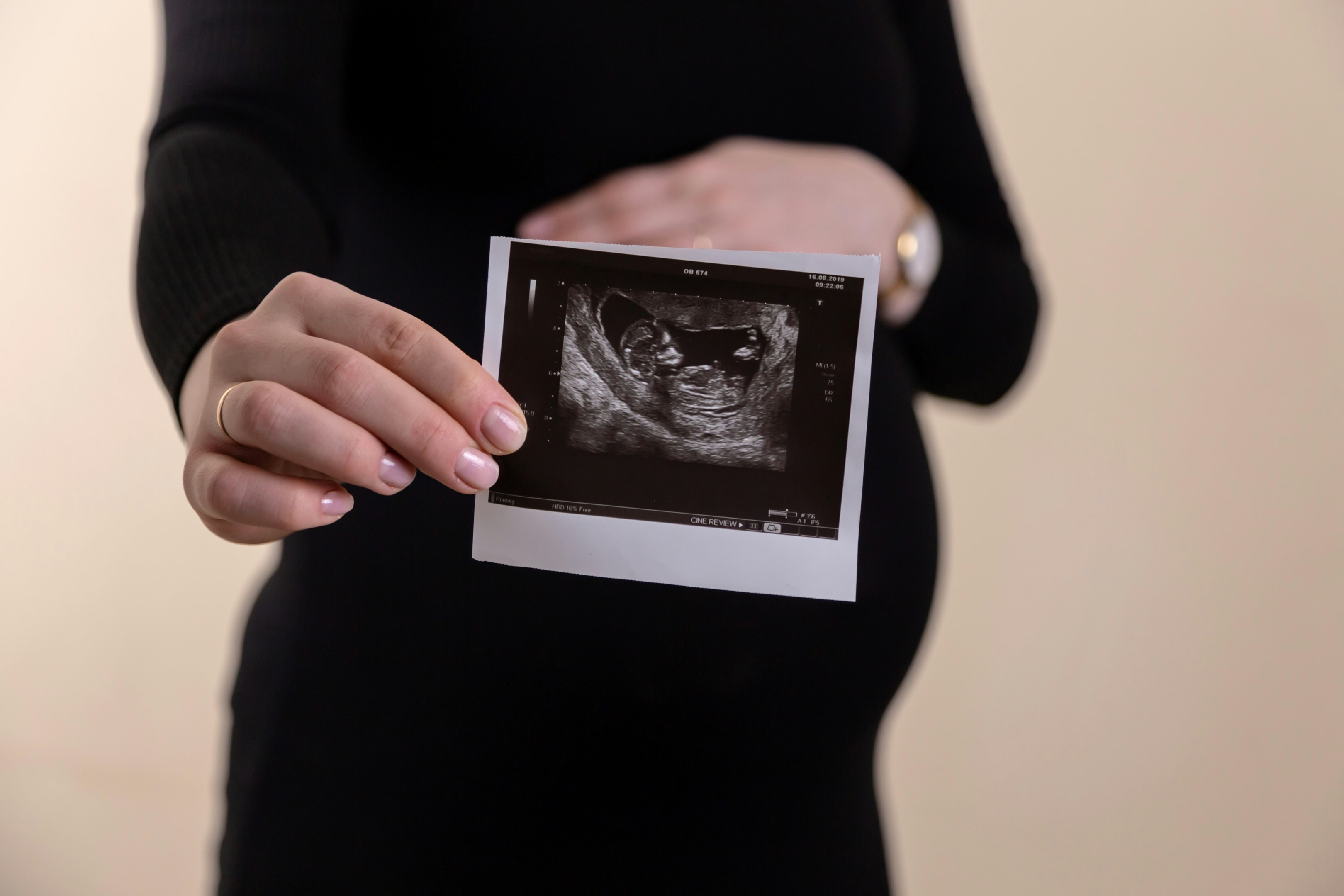 How much magnesium is needed during pregnancy depends on individual needs, but supplementation can help prevent deficiency