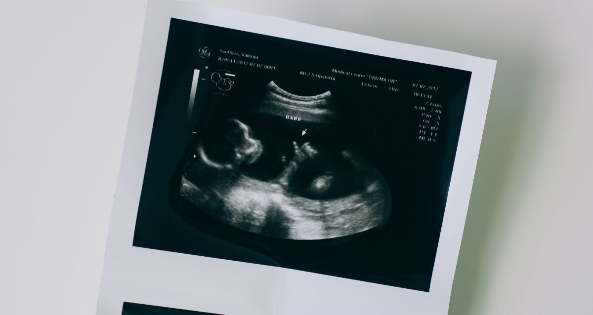 The gestational carrier is not thee biological mother 
