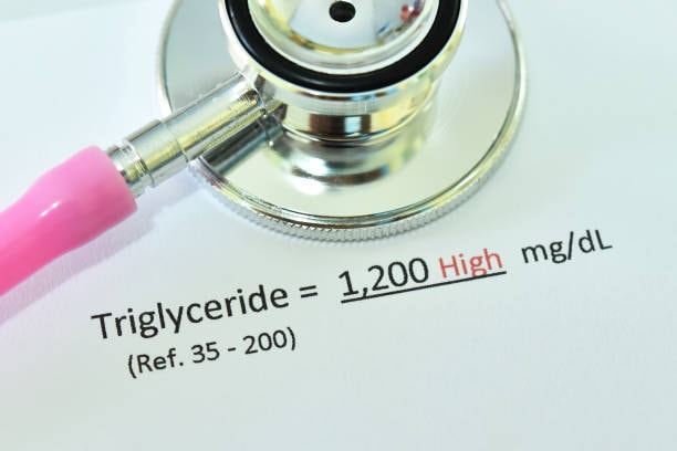 How to reduce triglycerides | Lose Weight | Low density Lipoprotein | Heart Disease Risk Factors | Excess Body Fat | High blood Cholesterol | Healthy Diet | High Blood Triglycerides | Avoid trans Fats | Low Fat Milk | Soy Milk | Fatty Foods | Reduce Triglycerides | Elevated Triglycerides | Fried foods | Monounsaturated Fats | Regularly Eat | Triglyceride Circulate | Foods high | Canola Oil | High fat foods | High Density Lipoprotein | Thyroid Hormones | High Doses | Simple Blood Test | Healthy eating |