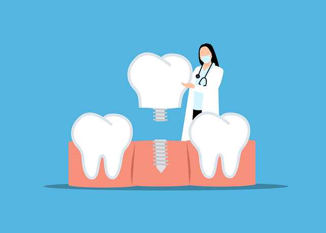 dental, implant, oral health