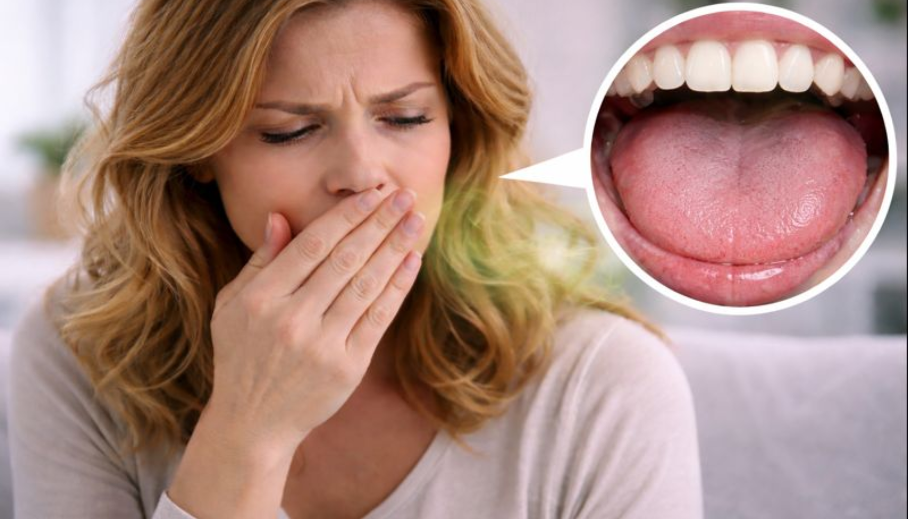 Kvinne dekker munnen med hånden og ser bekymret ut, med nærbilde av ren tunge og tenner ved siden av.