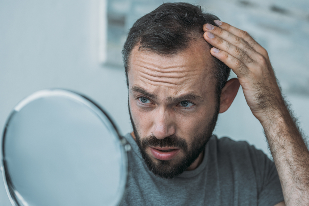 Man looking at his receding hairline in the mirror