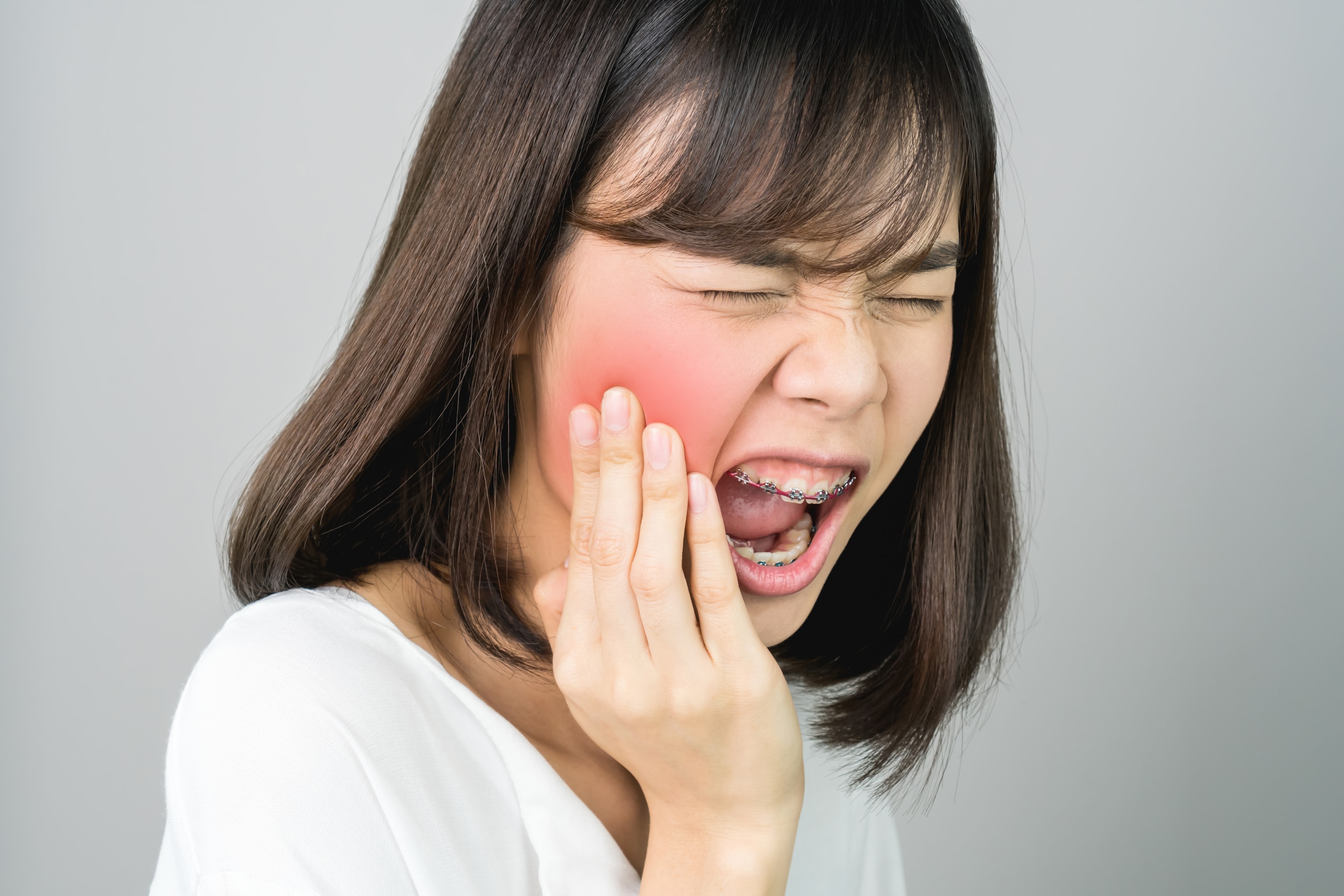 Girl with a gum infection after getting her wisdom teeth removed