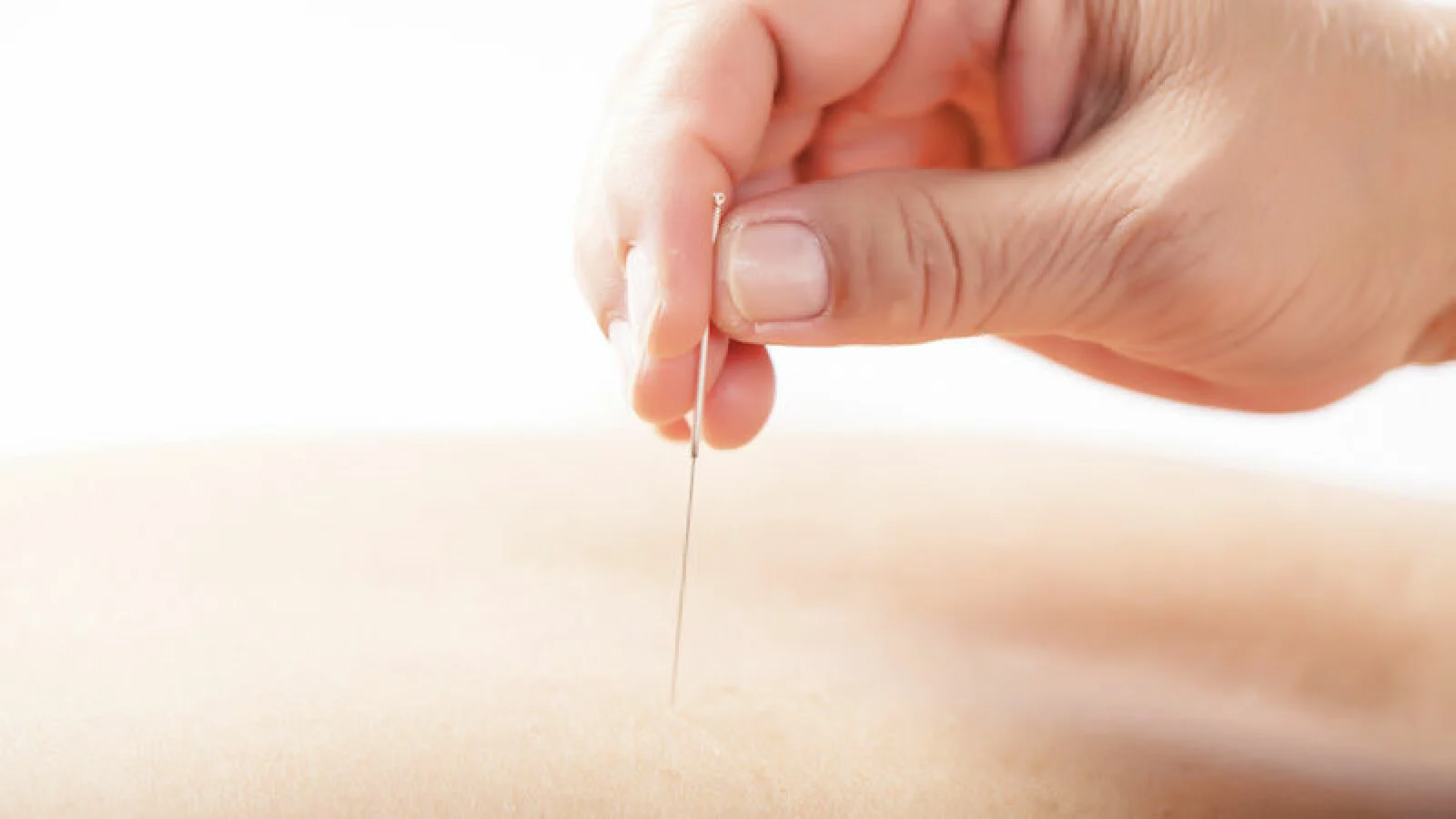 Akupunktur kan hjälpa under klimakteriet