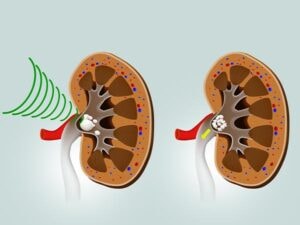 Patient Selection and Preparation