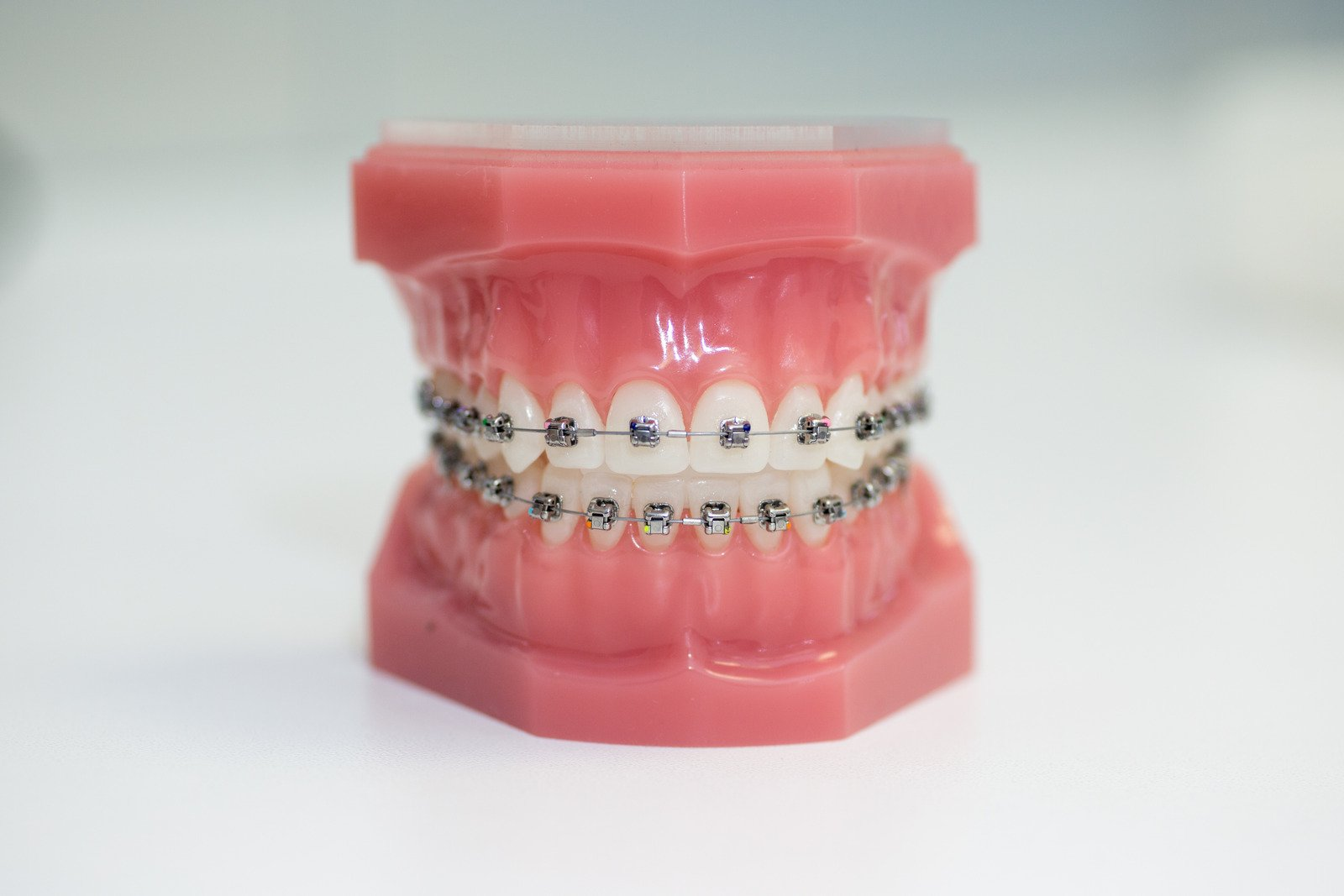 When to Start Orthodontic Treatment - Randall Orthodontics